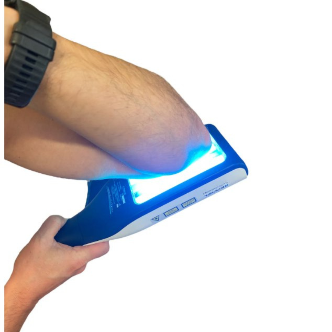 Portable UVB Light Therapy Lamp | Narrowband UVB for Psoriasis Relief