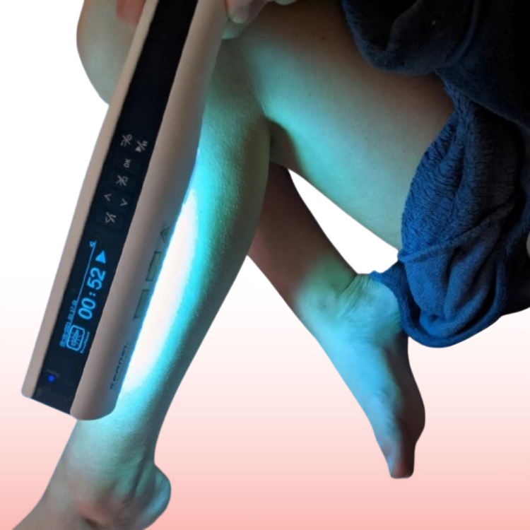 Handheld UVB Light Therapy Lamp – Psoriasis & Vitiligo Treatment